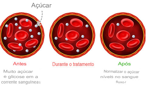 Healthify™ Pulseira reguladora de açúcar + EBOOK 107 receitas pró-diabetes (BRINDE)