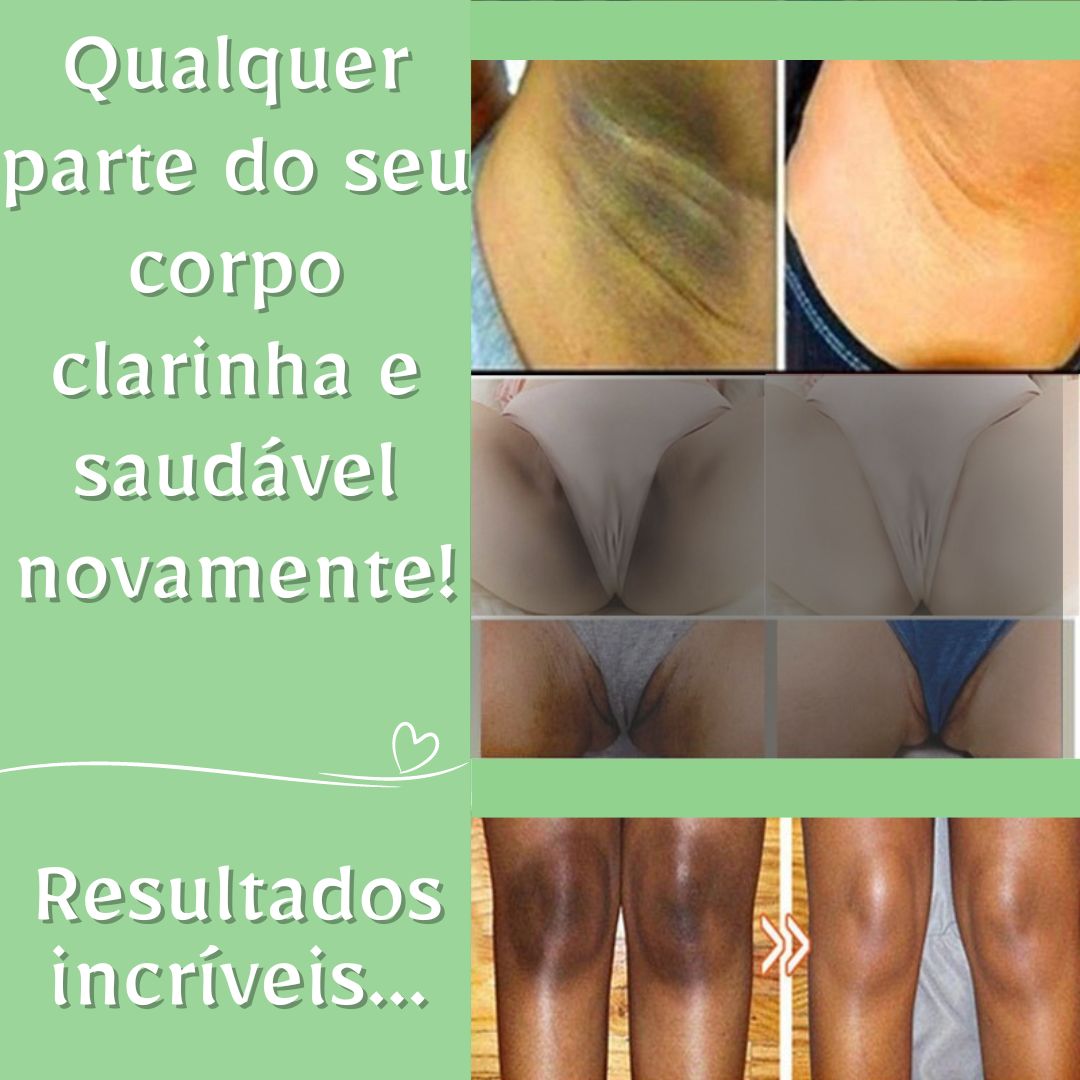 Creme Clareador de Pele Áreas Escurecidas - PerfectFace