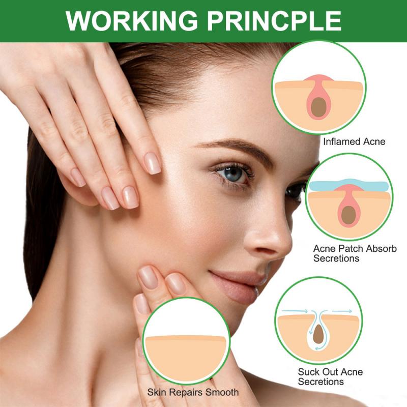 Adesivo para Acne Secativo e Clareador - 24 Peças