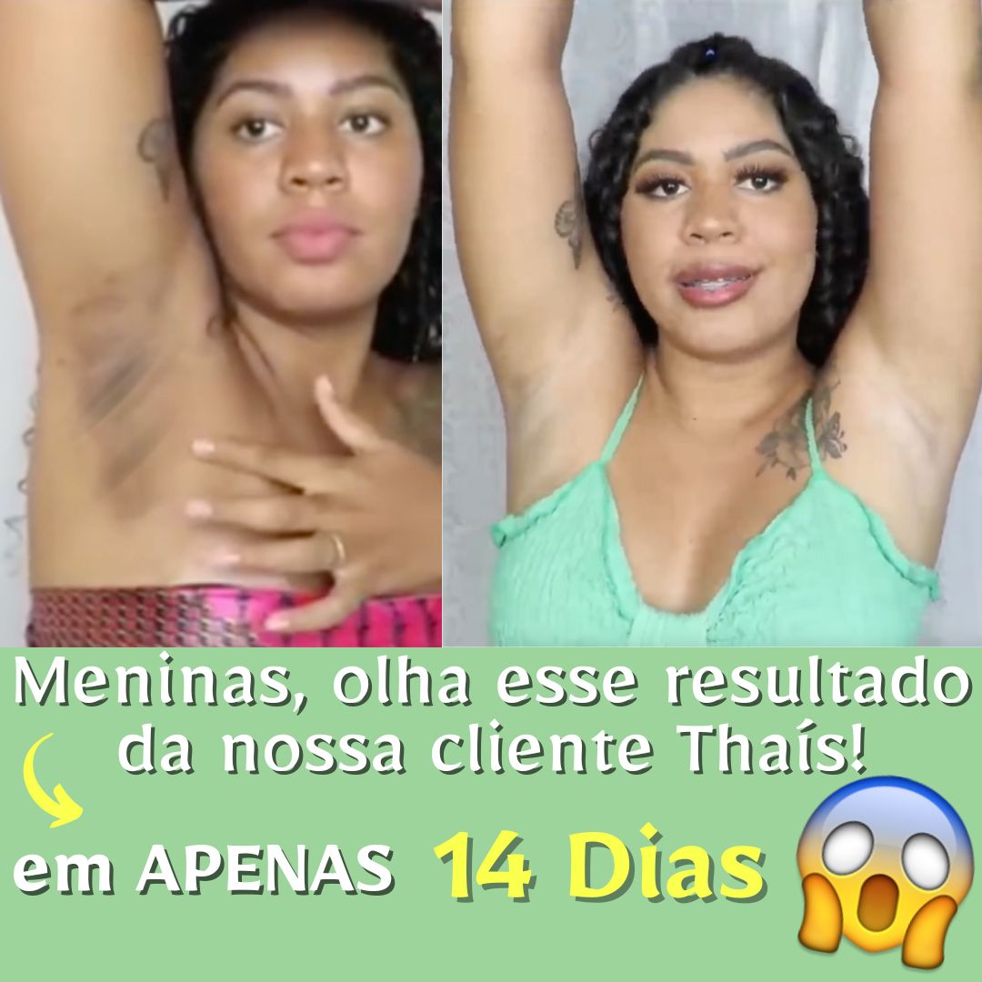 Creme Clareador de Pele Áreas Escurecidas - PerfectFace
