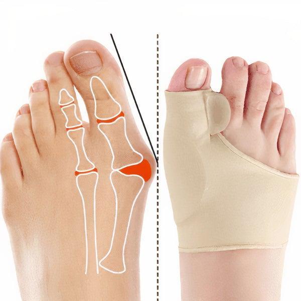 Joanete Slim® - Par de Corretores Ortopédicos