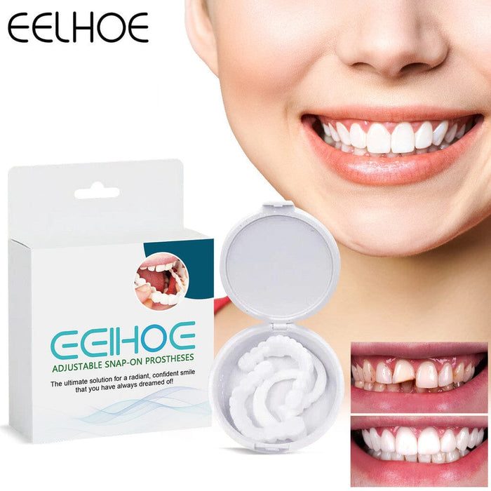 Lente de Contato Dental Removível Inferior e Superior