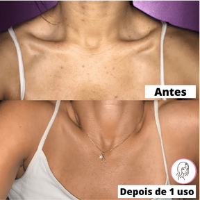 Luvas Esfoliantes de Banho SkinSoft